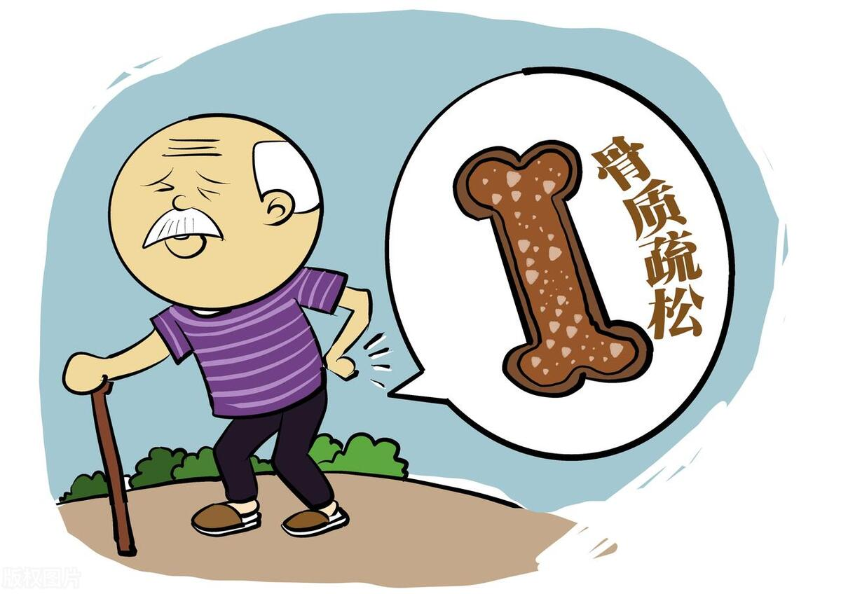 骨質疏松是中老年人群重常見的疾病之一 骨質疏松是中老年人群重常見的疾病之一